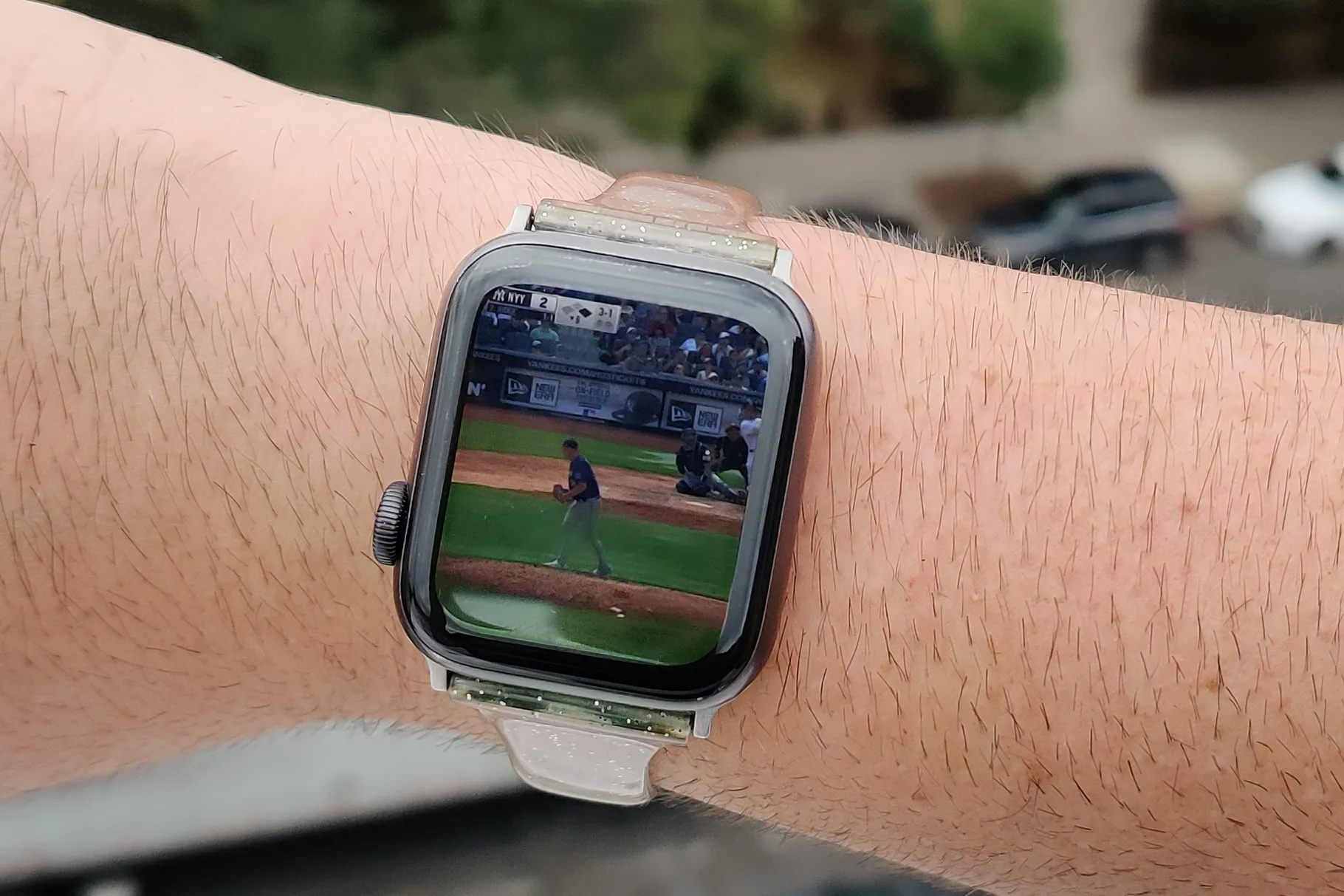 You Should Be Able To Watch TV On Your Apple Watch